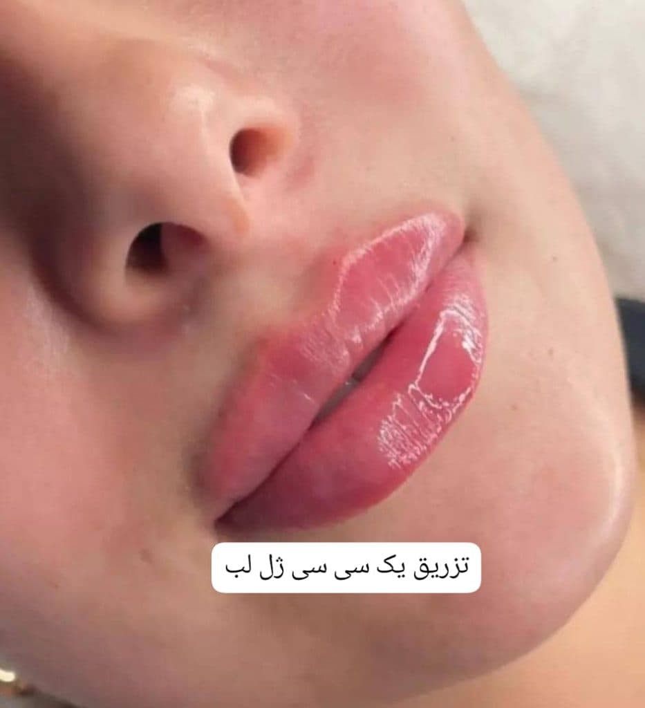 کلینیک زیبایی پوست و مو نهال در تهران