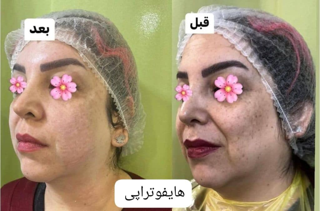 کلینیک زیبایی پوست و مو نهال در تهران