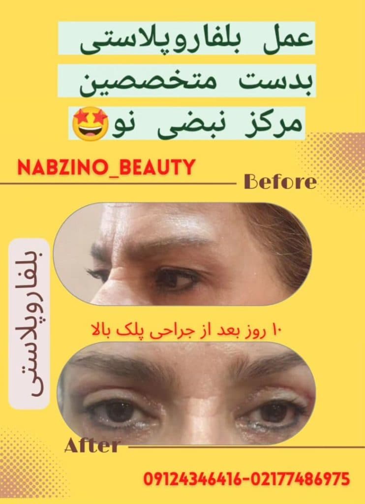 تست نوار مثانه کلینیک نبضی نو در پیروزی تهران