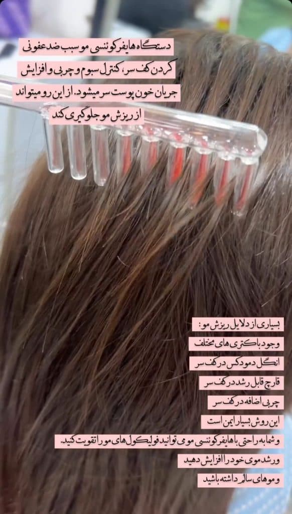 اسکالپ کف سر مهسا جعفری در رشت