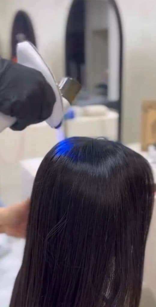 اسکالپ کف سر مهسا جعفری در رشت