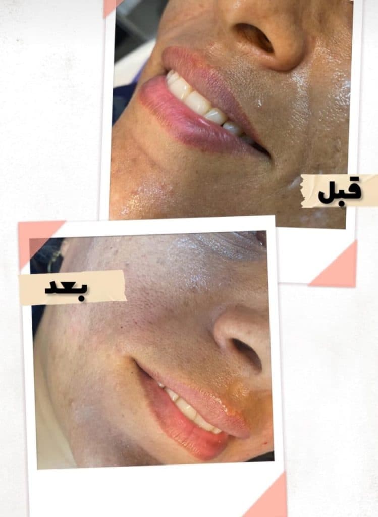 کلینیک زیبایی آرزو در سه راه پلنگ صورتی بندرعباس