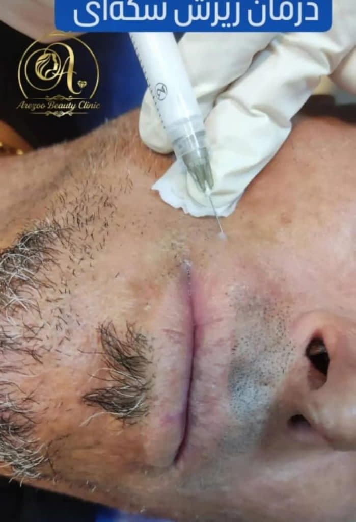 کلینیک زیبایی آرزو در سه راه پلنگ صورتی بندرعباس