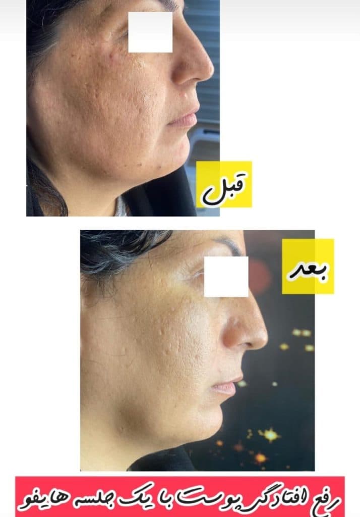 کلینیک زیبایی آرزو در سه راه پلنگ صورتی بندرعباس