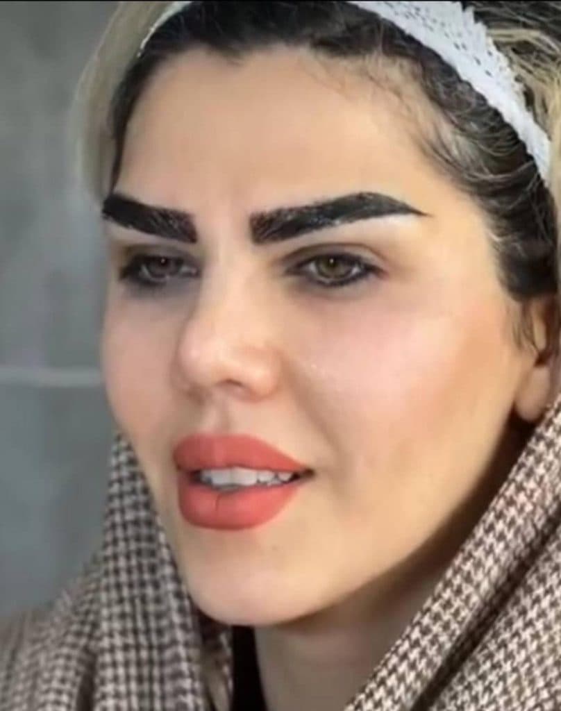 کلینیک کاشت مو و ابرو کوردکاشت kurdkasht در سقز