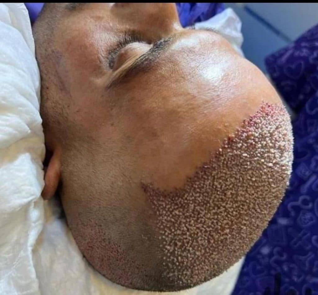 کلینیک کاشت مو و ابرو کوردکاشت kurdkasht در سقز
