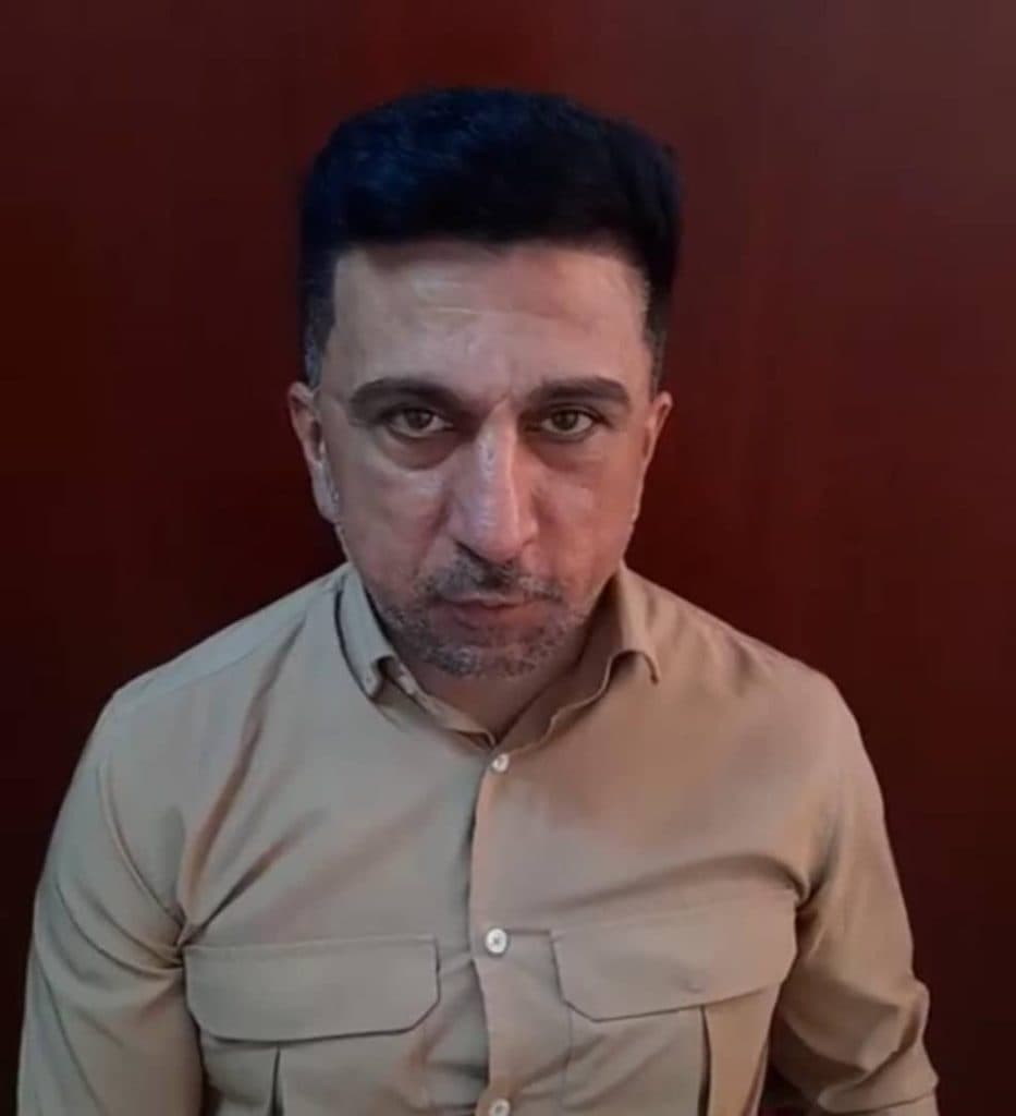 کلینیک کاشت مو و ابرو کوردکاشت kurdkasht در سقز