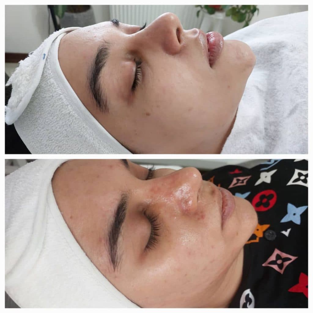 فشیال تخصصی پوست آلما در فردیس