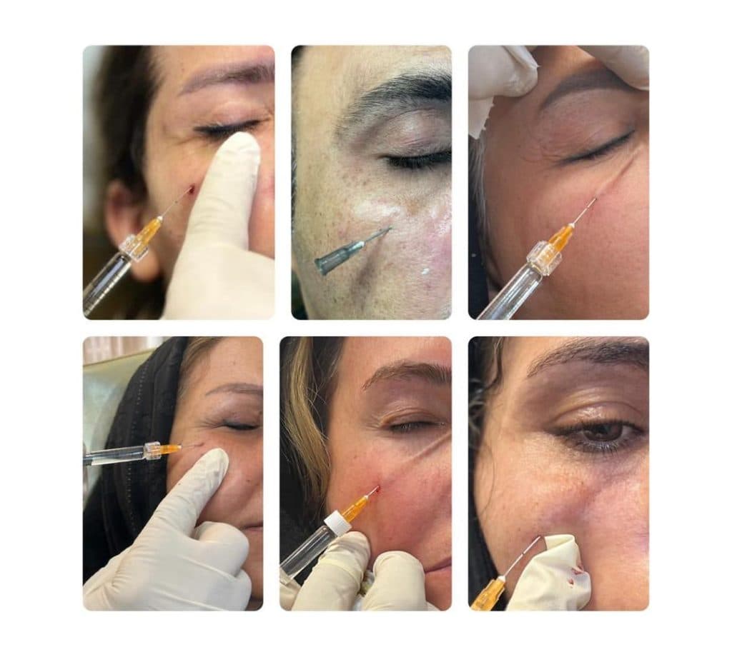 مطب زیبایی دکتر رضا محمدی در امیرکبیر شیراز