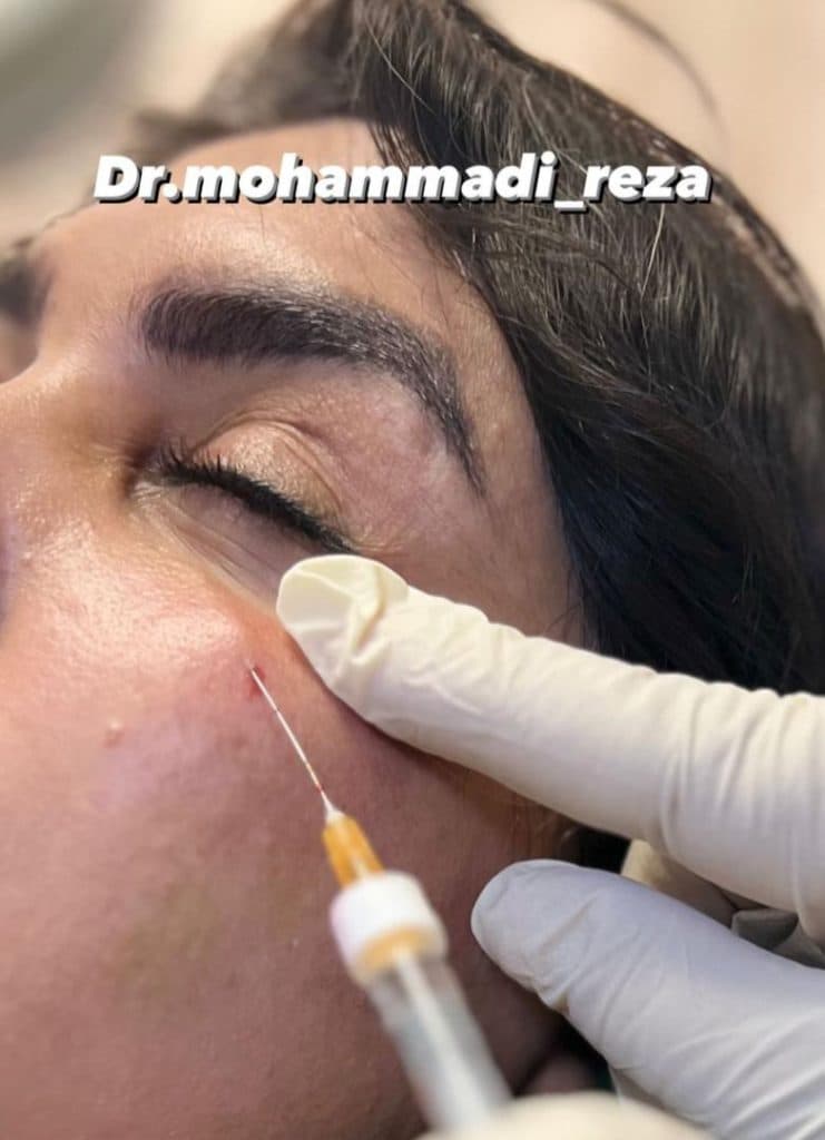 مطب زیبایی دکتر رضا محمدی در امیرکبیر شیراز