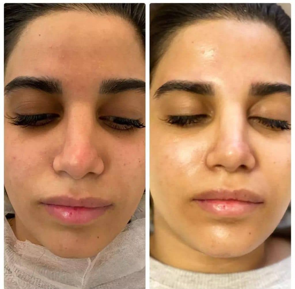 خدمات زیبایی و فیشیال پوست سحر چناری در معالی آباد شیراز