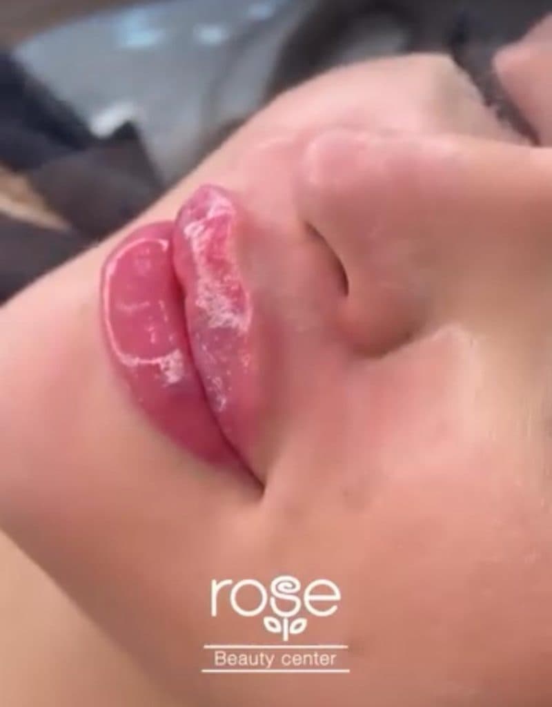 کلینیک زیبایی رز در چهارراه نظام وفا قزوین