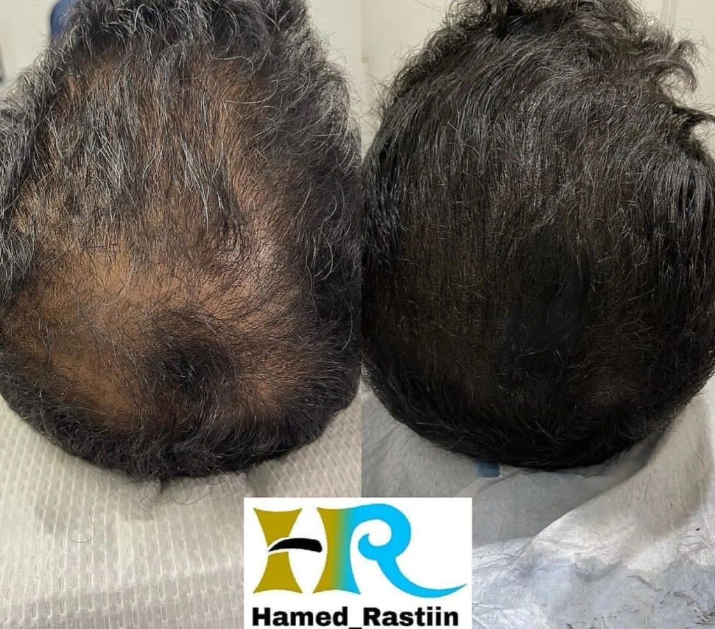 کلینیک زیبایی حامد راستین در تهران