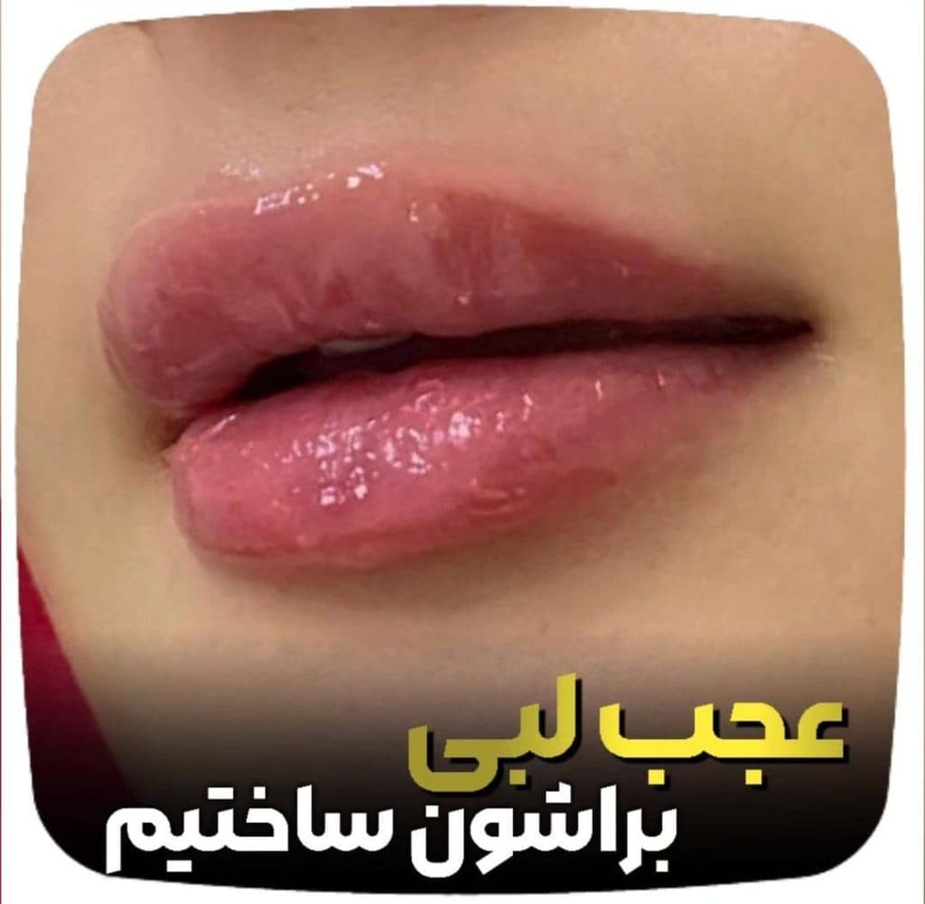 مطب زیبایی پوست و مو لامور در کرمان