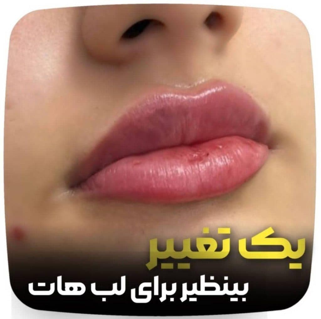 مطب زیبایی پوست و مو لامور در کرمان