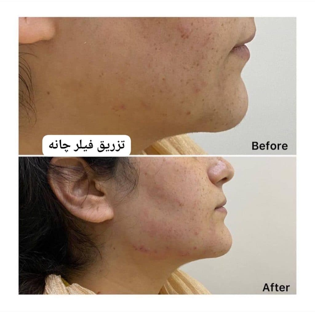 مطب زیبایی پوست و مو لامور در کرمان