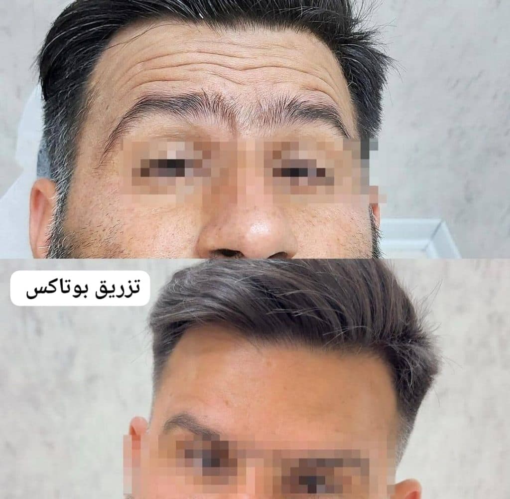 مطب زیبایی پوست و مو لامور در کرمان