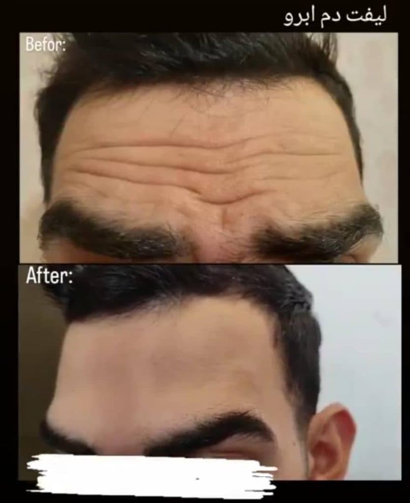 کلینیک زیبایی پوست و مو آفتاب در کرمان