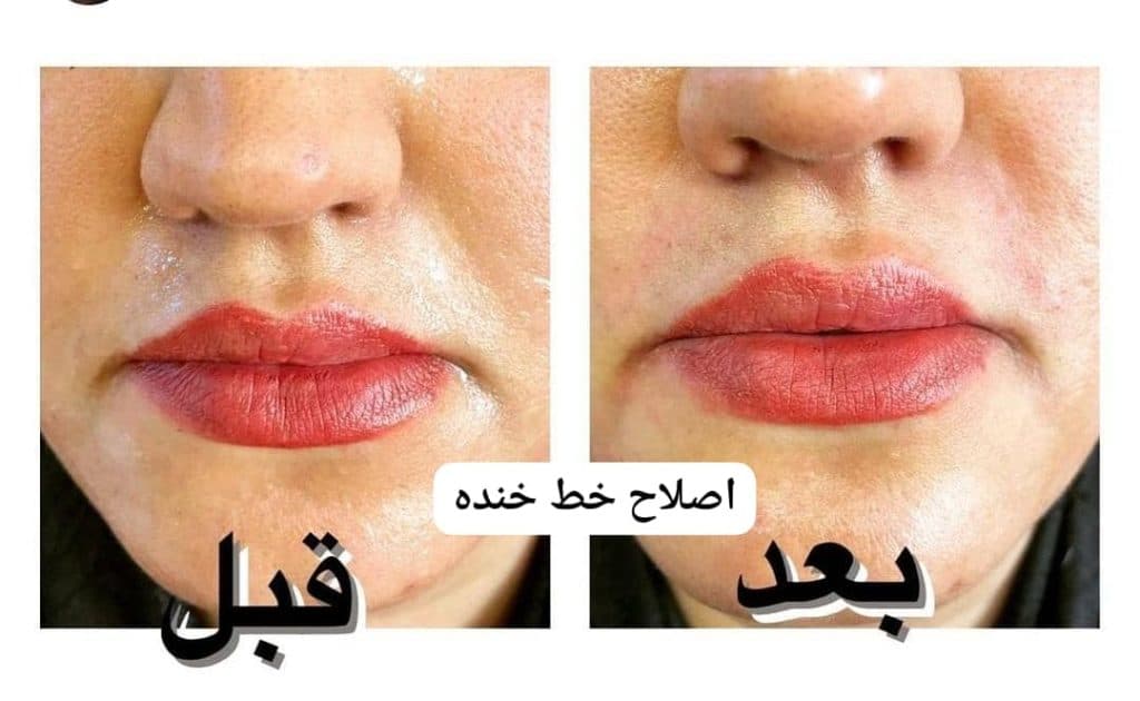 مطب زیبایی پوست و مو دکتر کوروش بزرگ ساوجی در سید خندان تهران