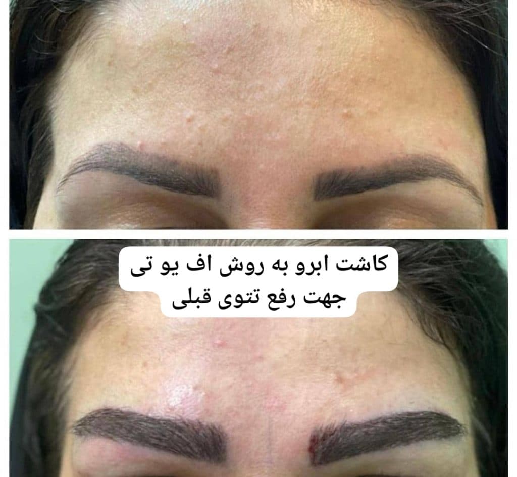 مطب زیبایی پوست و مو دکتر کوروش بزرگ ساوجی در سید خندان تهران