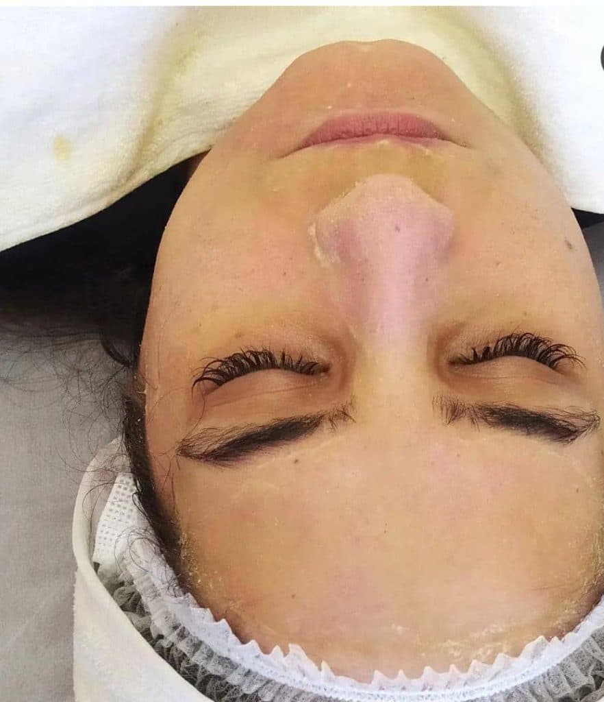 فیشیال تخصصی خانه پوست نجلا در معالی آباد شیراز