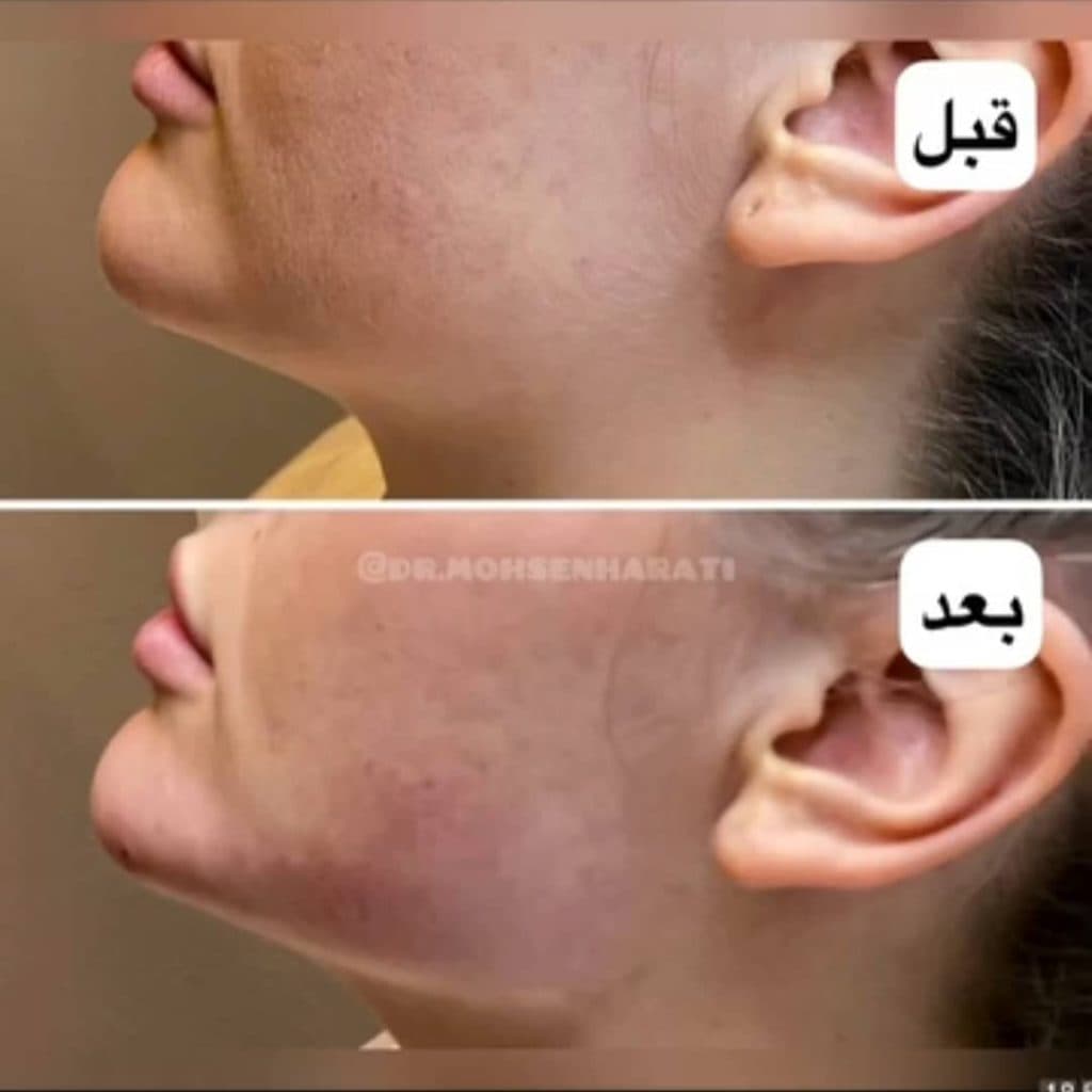 مرکز لیزر زیتون اهواز