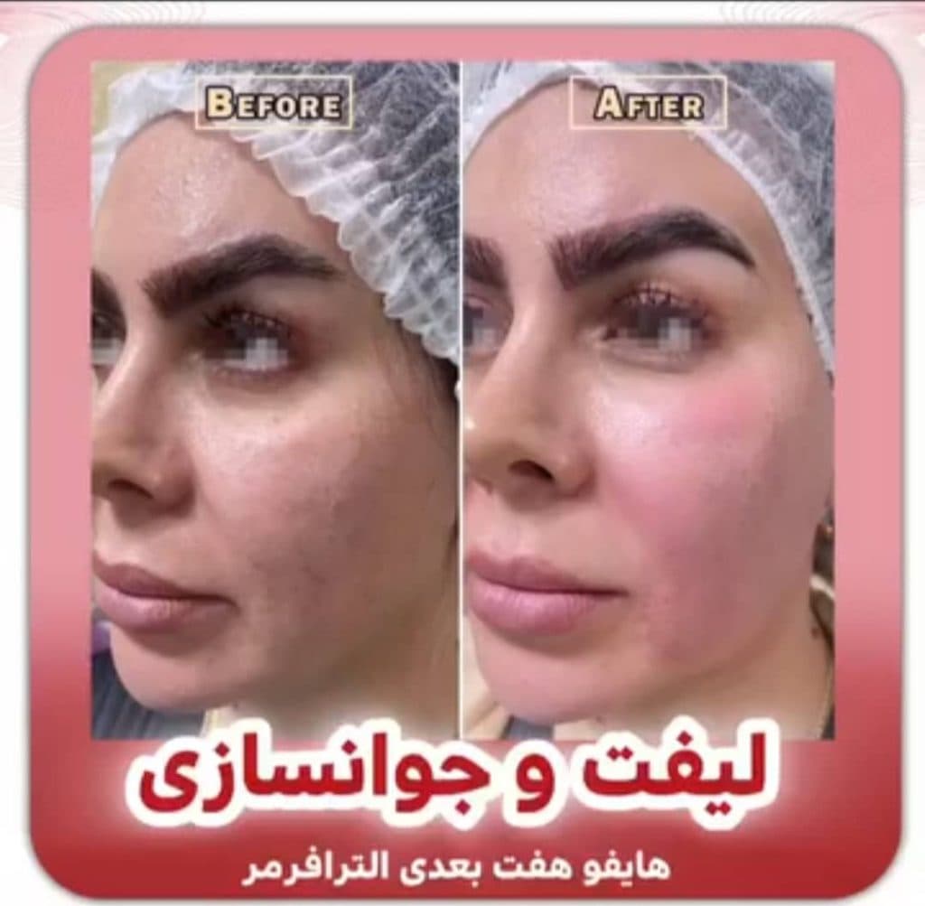 مرکز لیزر زیتون اهواز