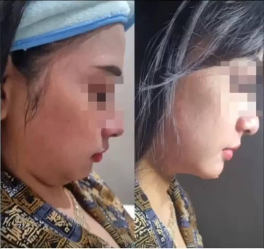 مرکز لیزر زیتون اهواز