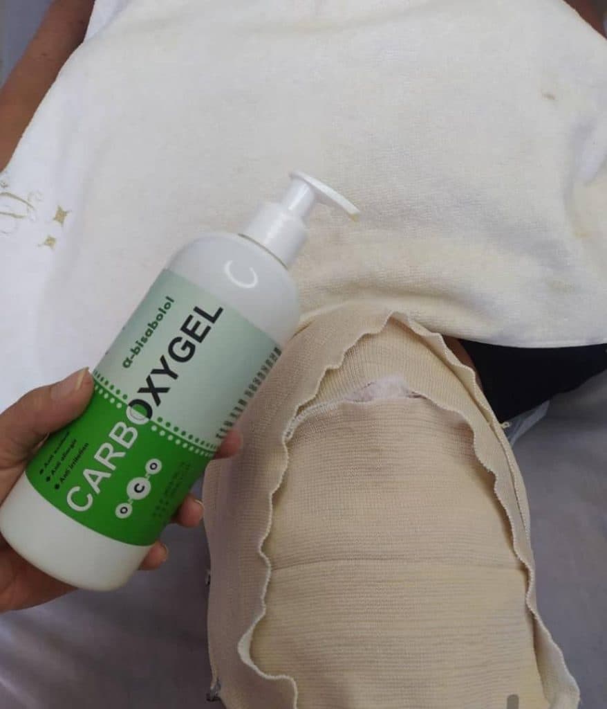 خدمات زیبایی و فیشیال پوست نادیا رسولی در مشهد