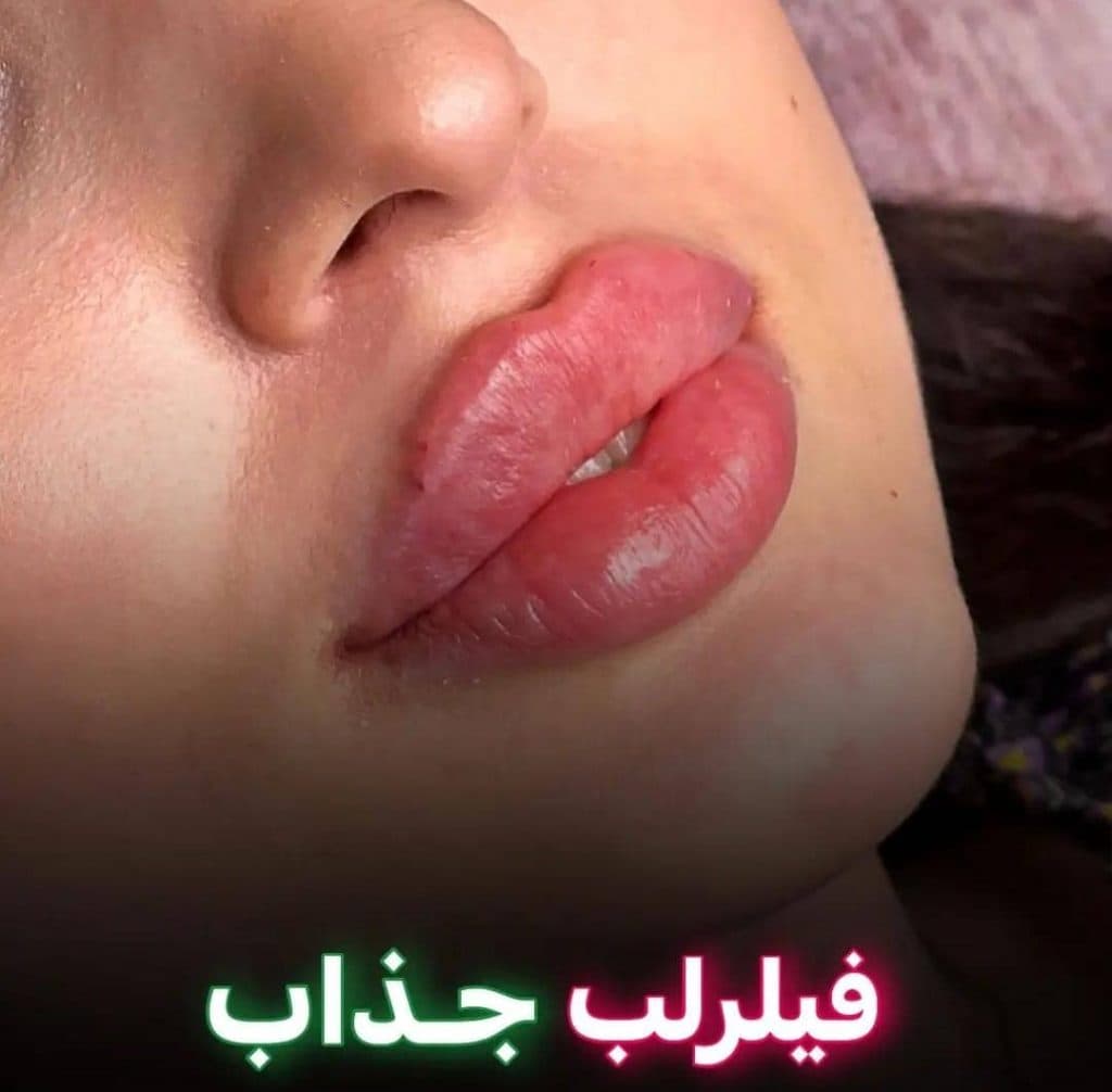 مرکز زیبایی لیزر مهیاد در تهران