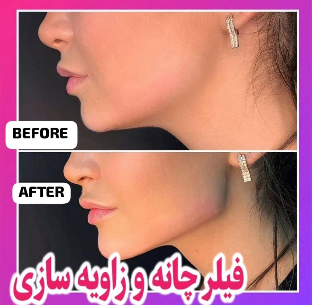 مرکز زیبایی لیزر مهیاد در تهران