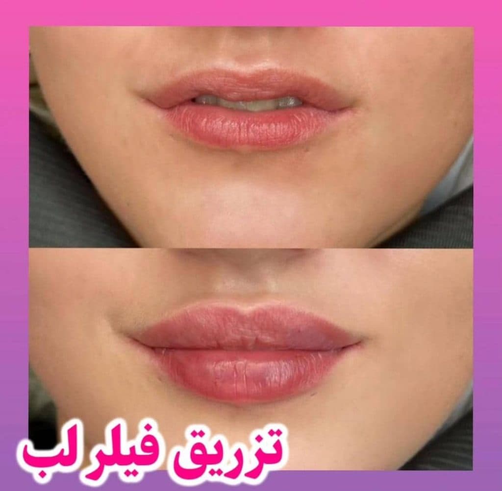 مرکز زیبایی لیزر مهیاد در تهران