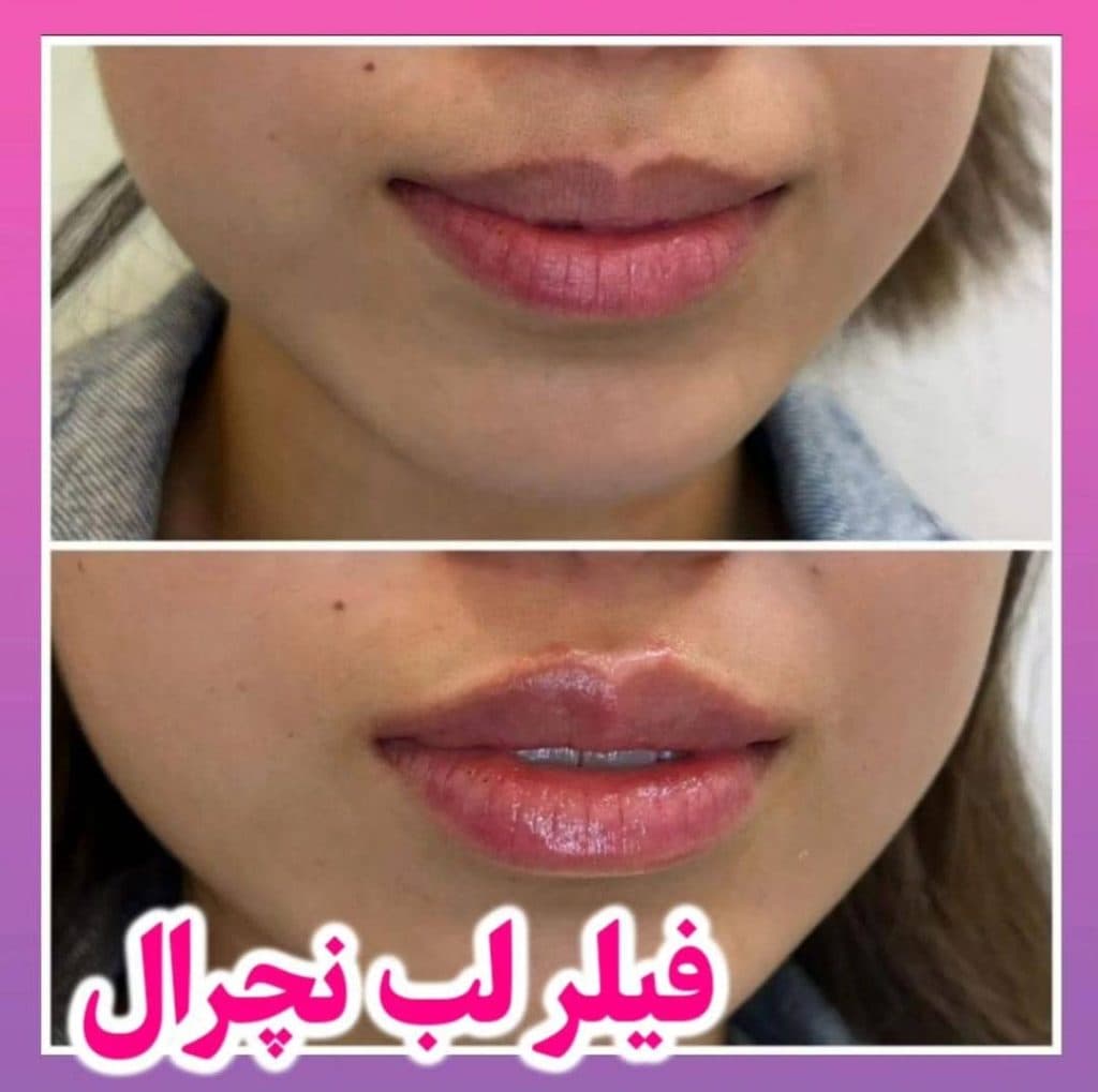 مرکز زیبایی لیزر مهیاد در تهران