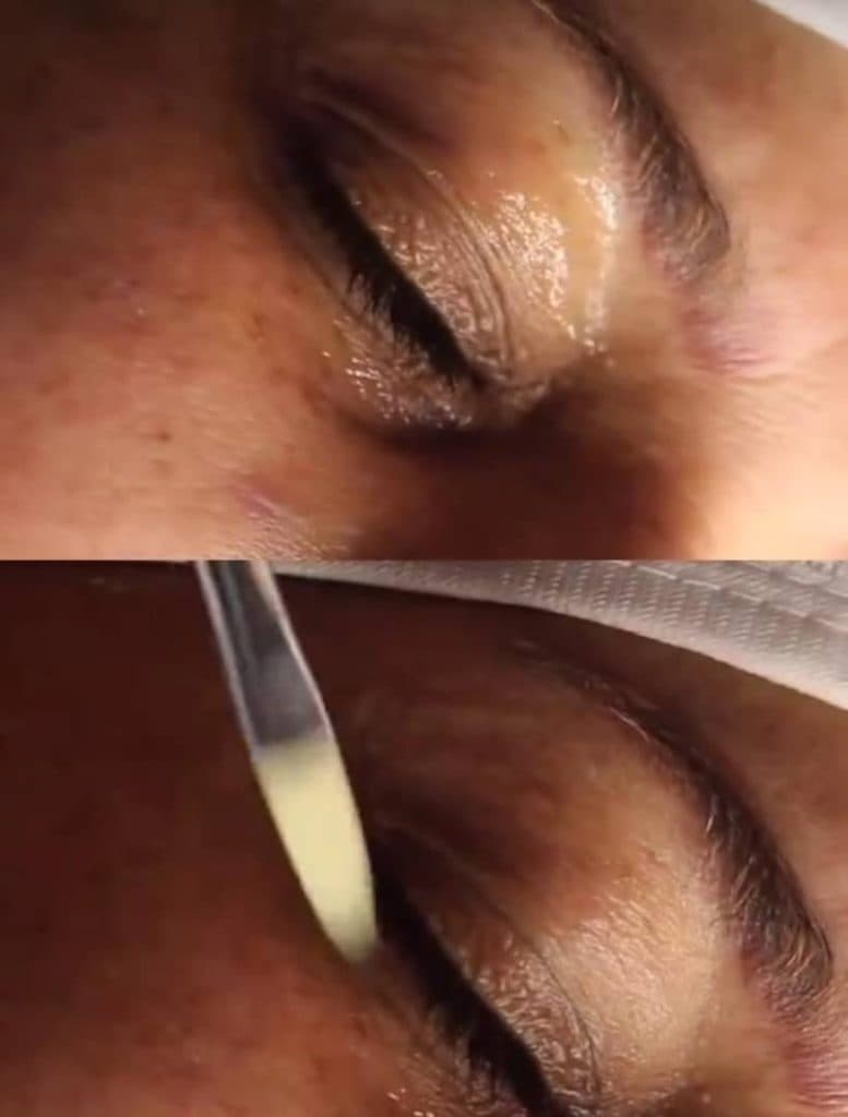 خدمات زیبایی و فیشیال پوست مهسا عبدالعلی زاده در تهران