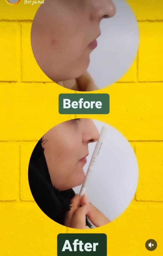 کلینیک زیبایی و لیزر داتیس در بیرجند