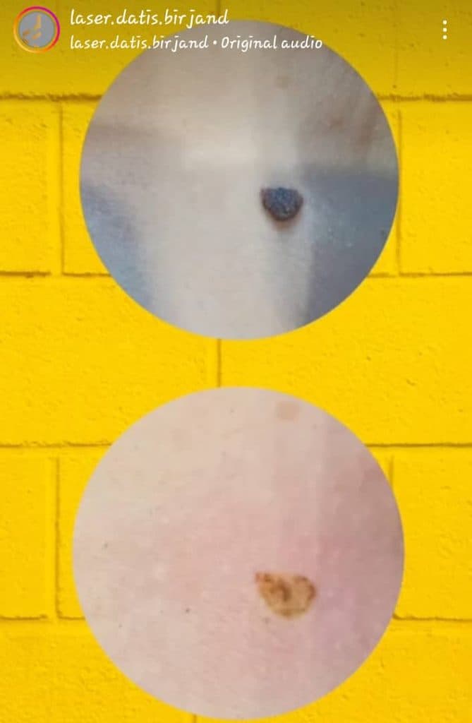 کلینیک زیبایی و لیزر داتیس در بیرجند