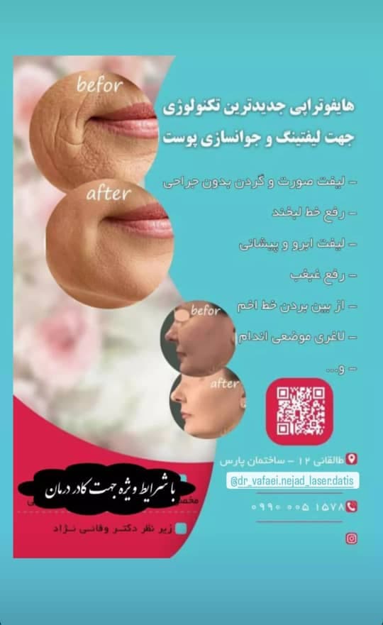 کلینیک زیبایی و لیزر داتیس در بیرجند