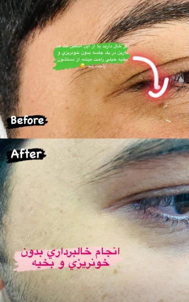 پزشک زیبایی پوست و مو دکتر عباس رشیدی در کرمان