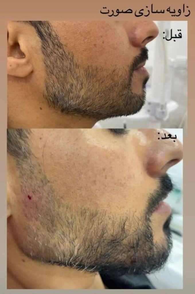 پزشک زیبایی پوست و مو دکتر عباس رشیدی در کرمان