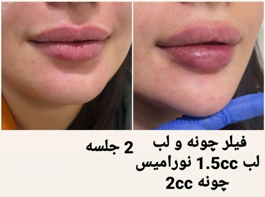 پزشک زیبایی پوست و مو دکتر عباس رشیدی در کرمان