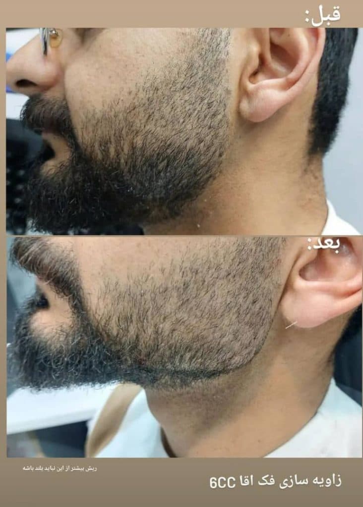 پزشک زیبایی پوست و مو دکتر عباس رشیدی در کرمان