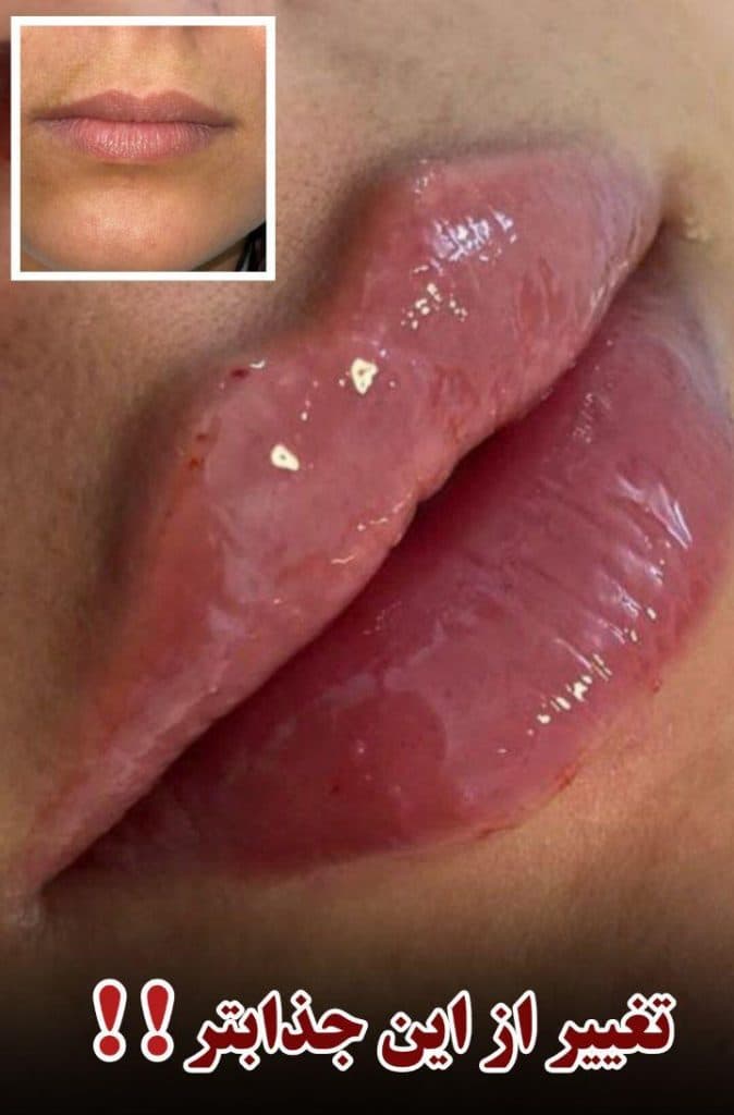 کلینیک زیبایی دکتر خوب در کرمانشاه