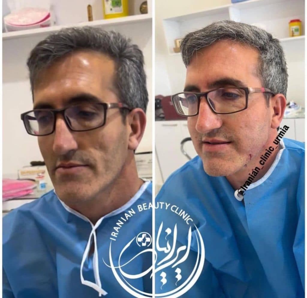 کلینیک زیبایی ایرانیان دکتر مهسا فتحی در ارومیه