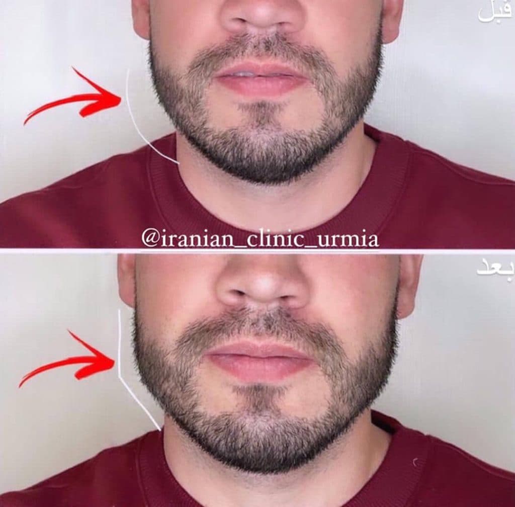 کلینیک زیبایی ایرانیان دکتر مهسا فتحی در ارومیه