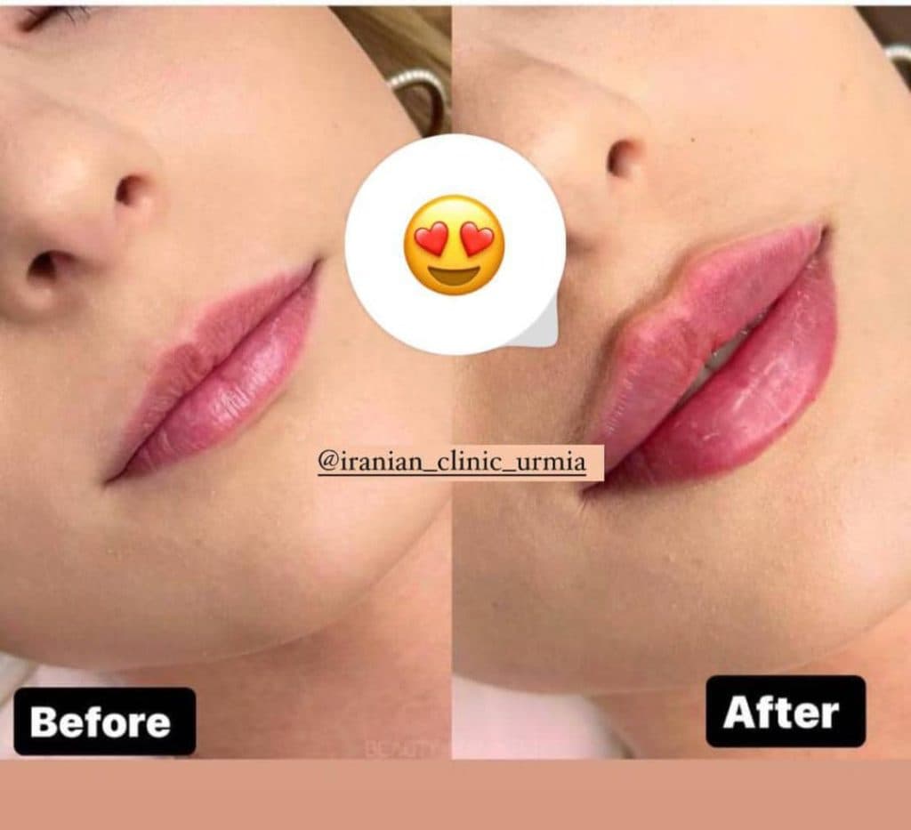 کلینیک زیبایی ایرانیان دکتر مهسا فتحی در ارومیه