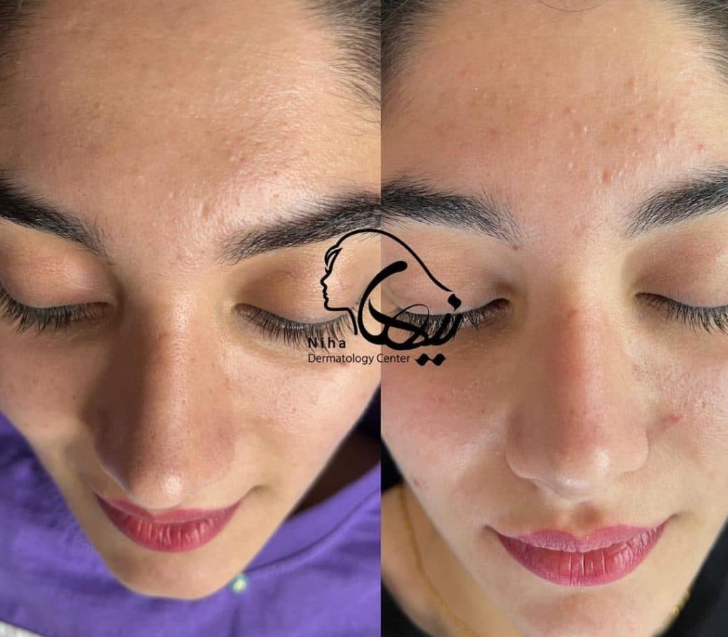 خدمات مراقبت از پوست و مو اسکین بیوتی نیها در محمودآباد