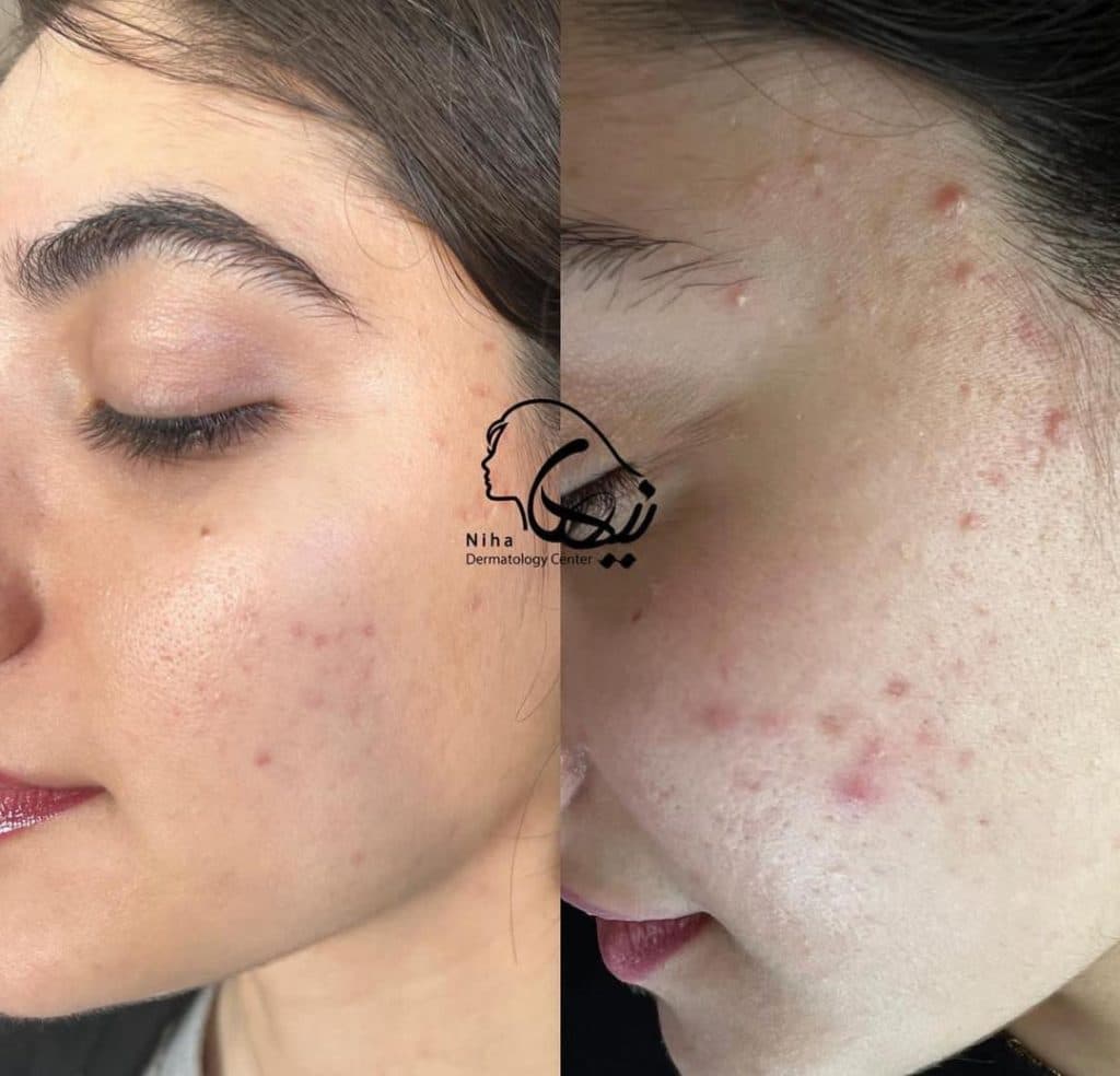 خدمات مراقبت از پوست و مو اسکین بیوتی نیها در محمودآباد