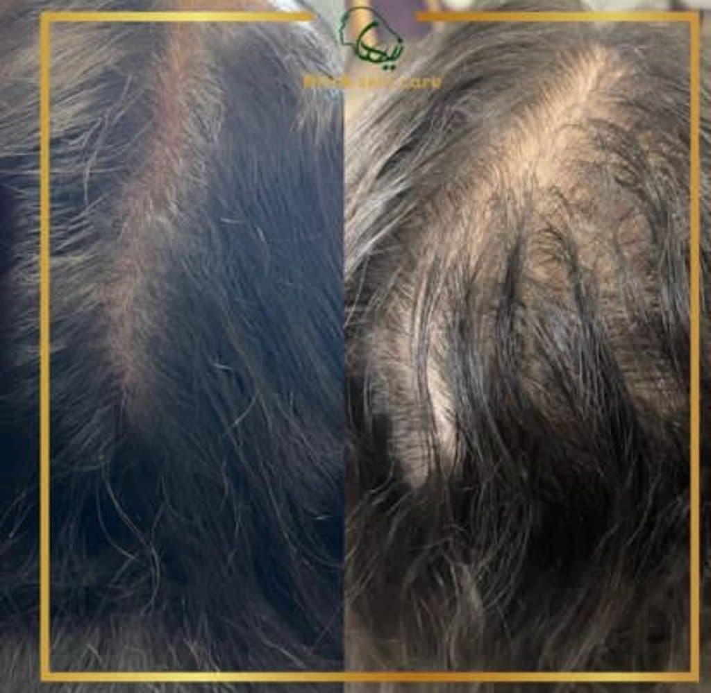 خدمات مراقبت از پوست و مو اسکین بیوتی نیها در محمودآباد