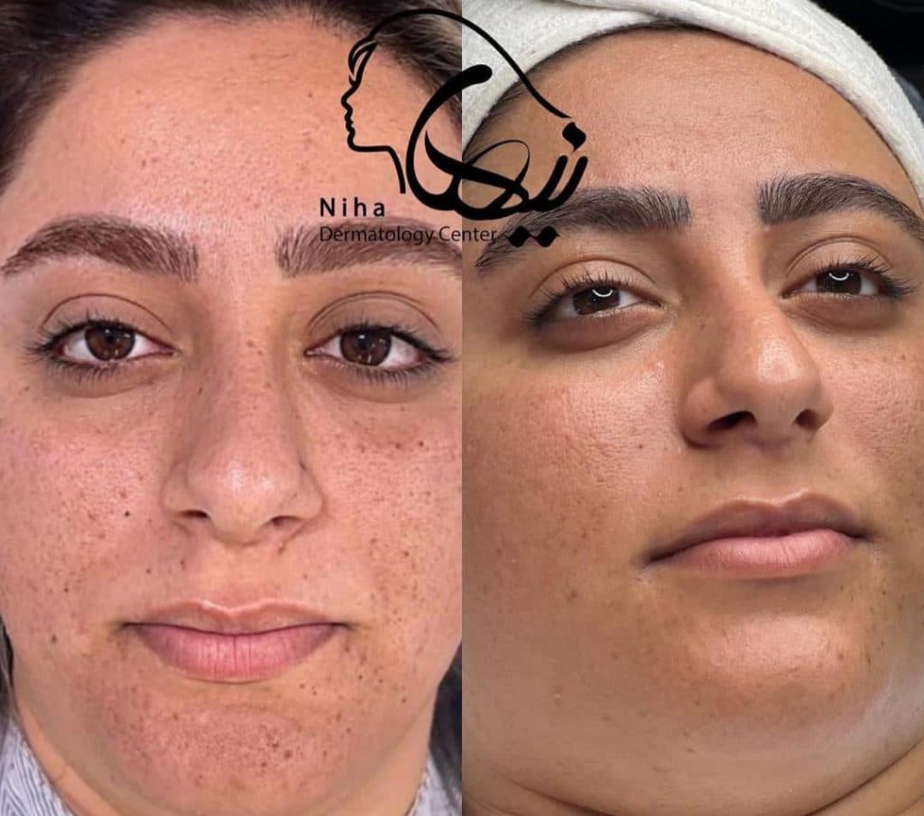 خدمات مراقبت از پوست و مو اسکین بیوتی نیها در محمودآباد