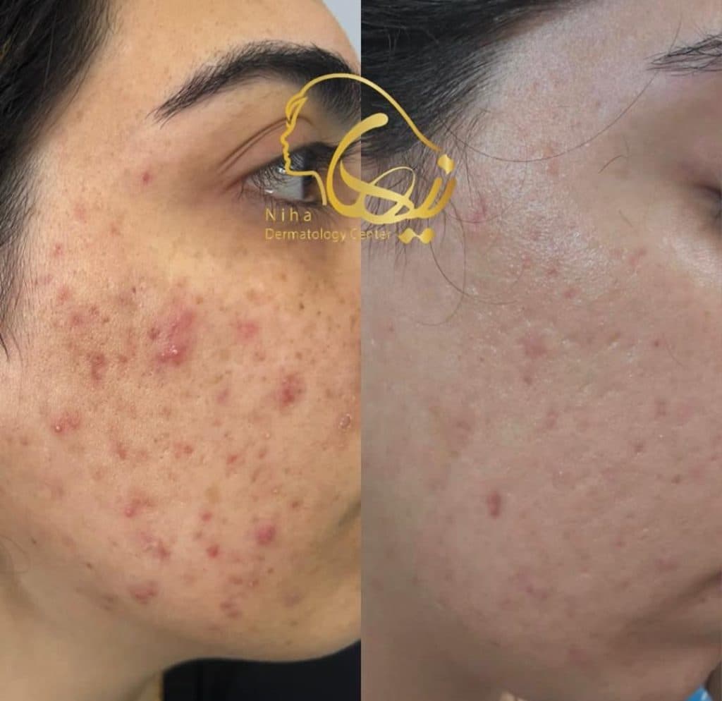 خدمات مراقبت از پوست و مو اسکین بیوتی نیها در محمودآباد